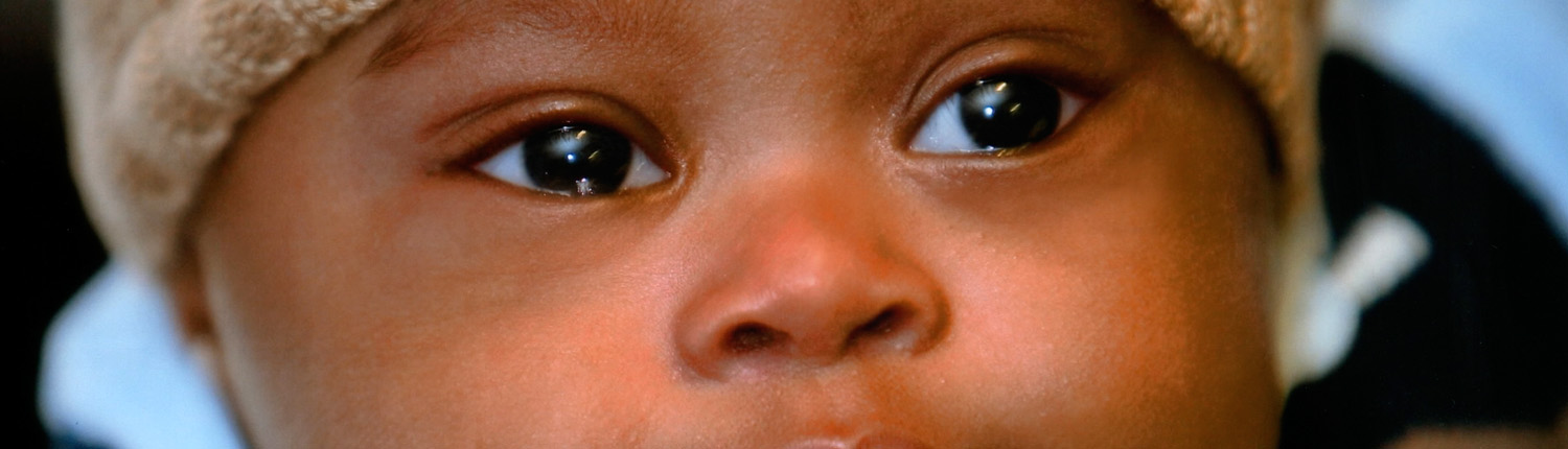 slider04 Genetic Alliance South Africa supporting families affected by congenital disorders