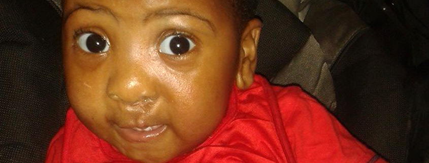 Understanding congenital disorders and birth defects in South Africa